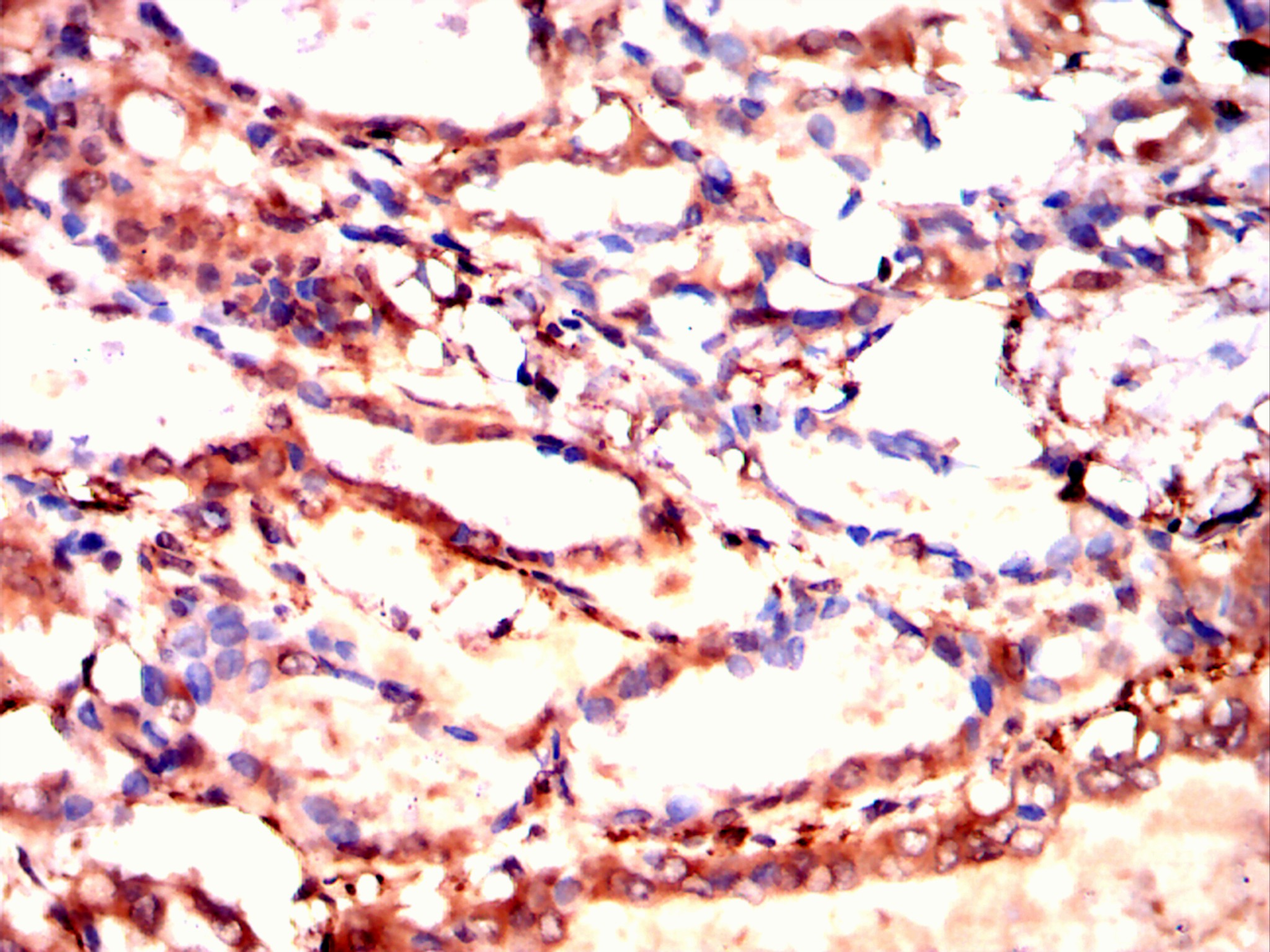 		IHC